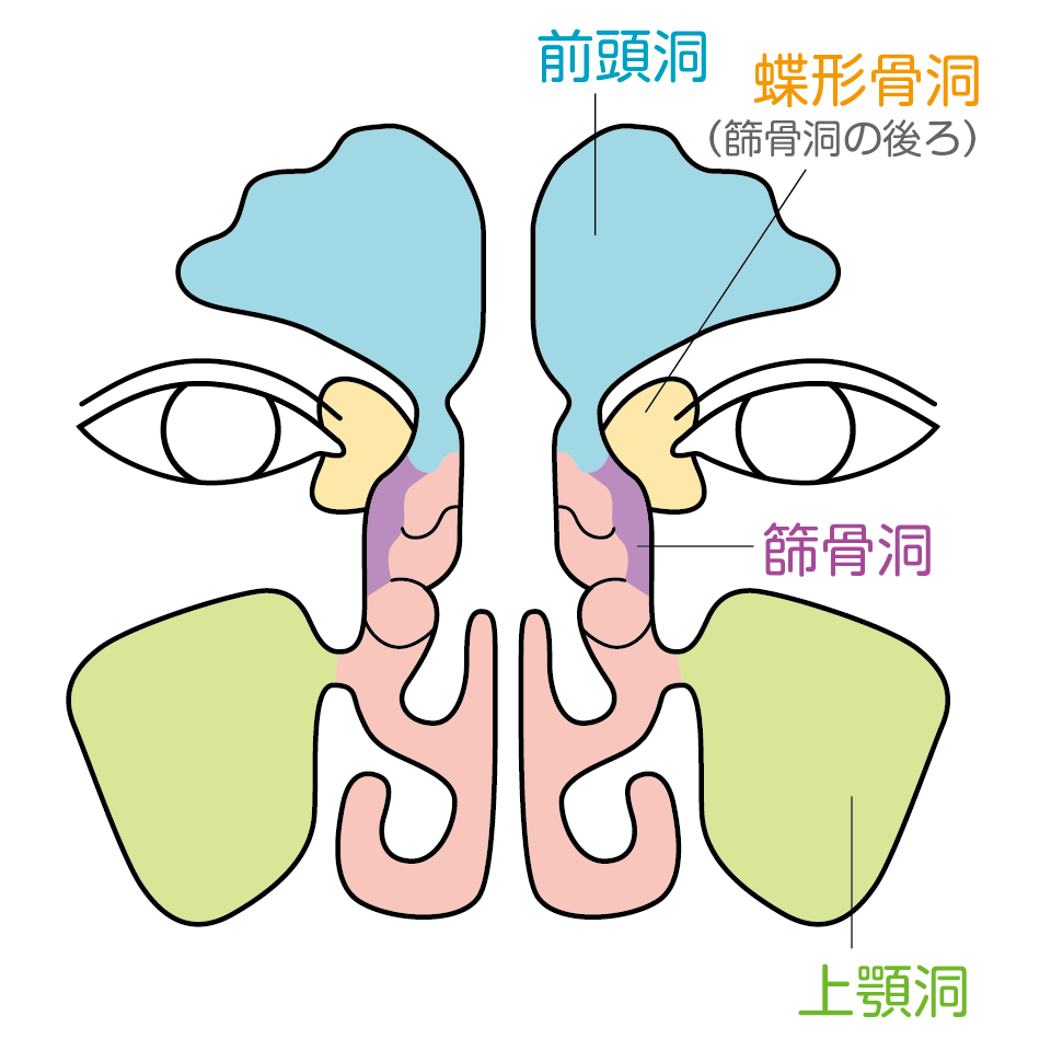 治りにくい慢性副鼻腔炎 大阪副鼻腔炎ドットコム 坂本クリニックグループ 副鼻腔炎 蓄膿症